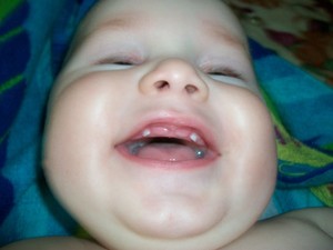 Как ребенок переносит этап появления зубов