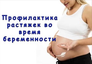 Беременность без потери красоты - профилактика растяжек