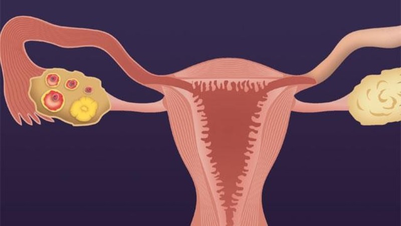 Желтое тело менструационного цикла