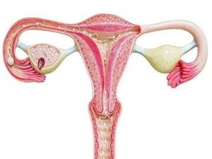 Симптомы опухоли яичника у женщин