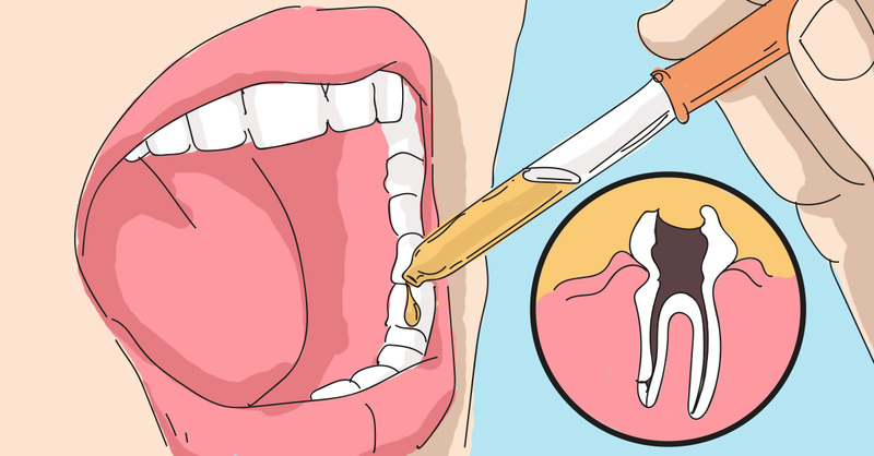 Как избавиться от зубной боли 