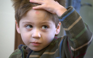Симптомы сотрясения головного мозга у детей