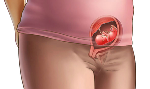 Два способа проверить беременность с помощью йода