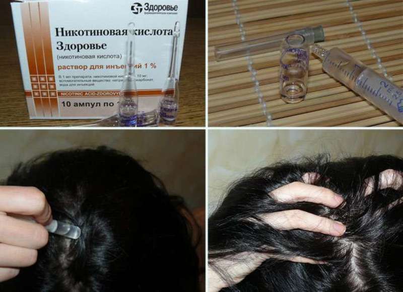 Способ применения никотиновой кислоты для волос