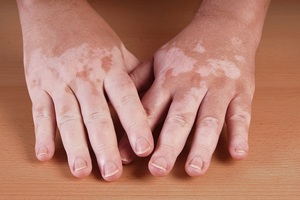 Самые распространённые заболевания кожи