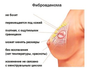 Первые симптомы мастопатии