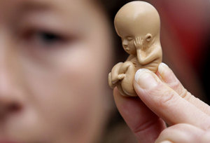 Аборт: патология прерывания беременности