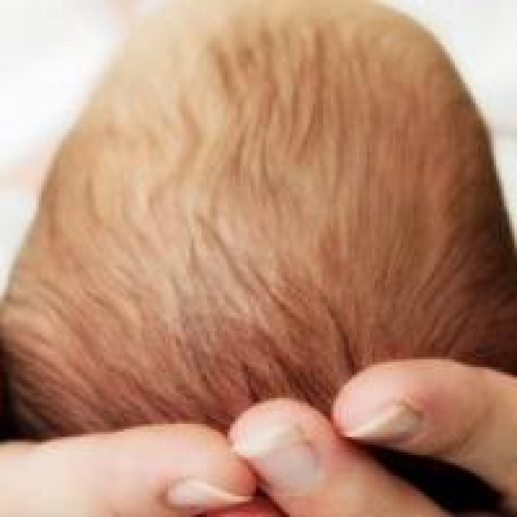 Состояние родничка. Корочки на голове у новорожденного. Родничок на голове у новорожденного.