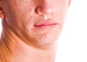 Профессиональное лечение дефектов на коже